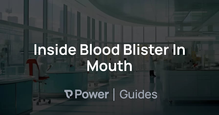 Header Image for Inside Blood Blister In Mouth