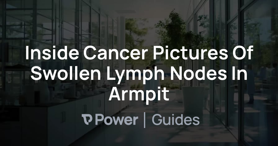Header Image for Inside Cancer Pictures Of Swollen Lymph Nodes In Armpit