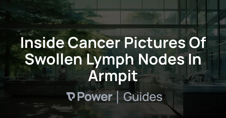 Header Image for Inside Cancer Pictures Of Swollen Lymph Nodes In Armpit