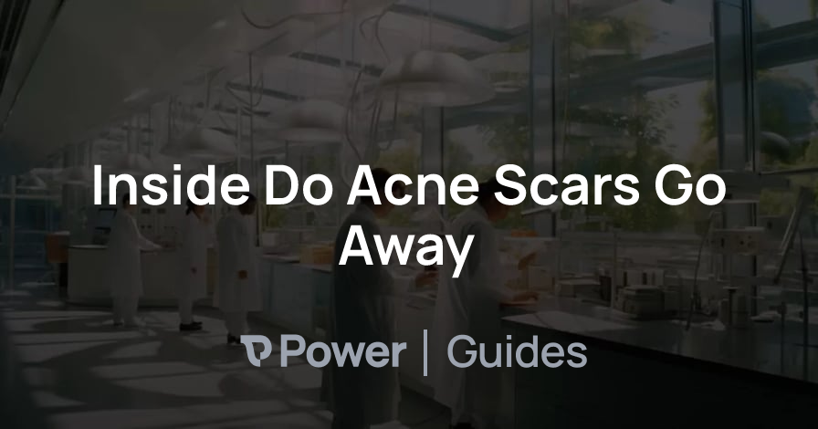 Header Image for Inside Do Acne Scars Go Away