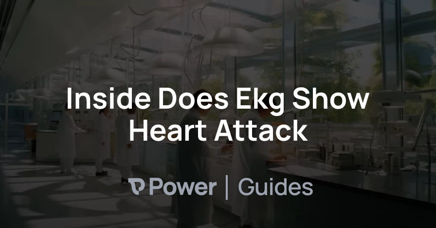 Header Image for Inside Does Ekg Show Heart Attack