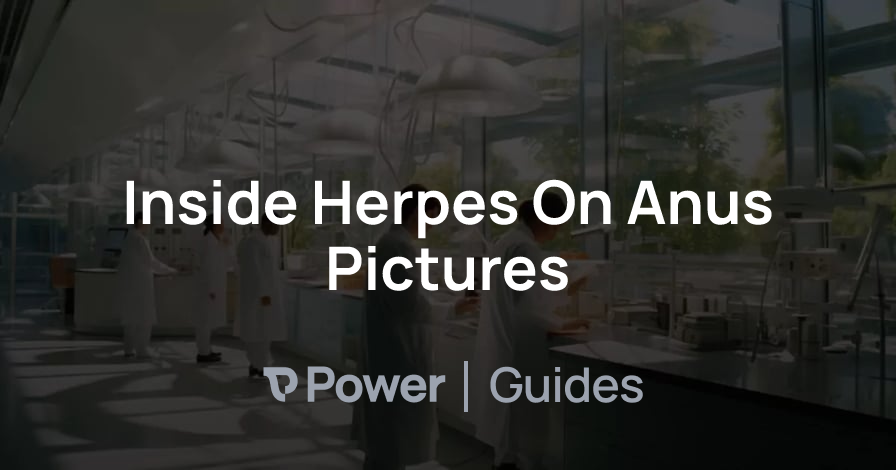 Header Image for Inside Herpes On Anus Pictures