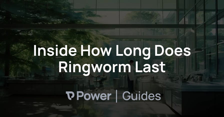 Header Image for Inside How Long Does Ringworm Last