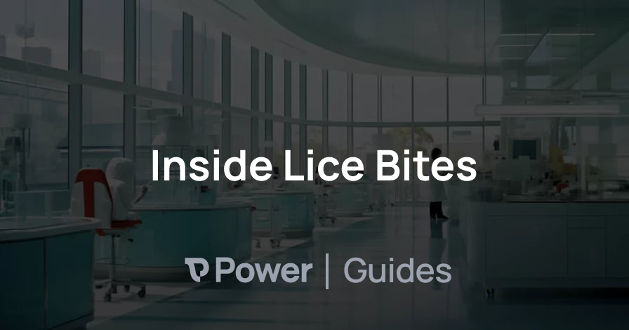 Header Image for Inside Lice Bites