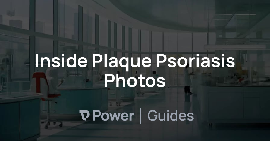 Header Image for Inside Plaque Psoriasis Photos