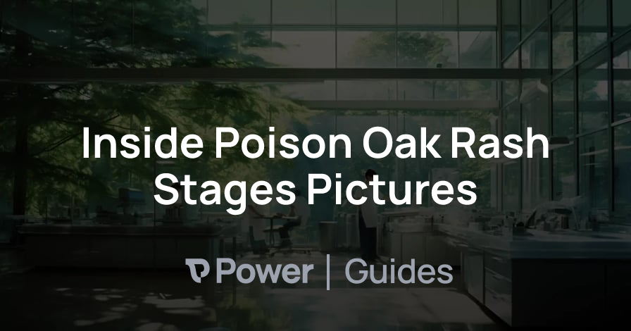 Header Image for Inside Poison Oak Rash Stages Pictures