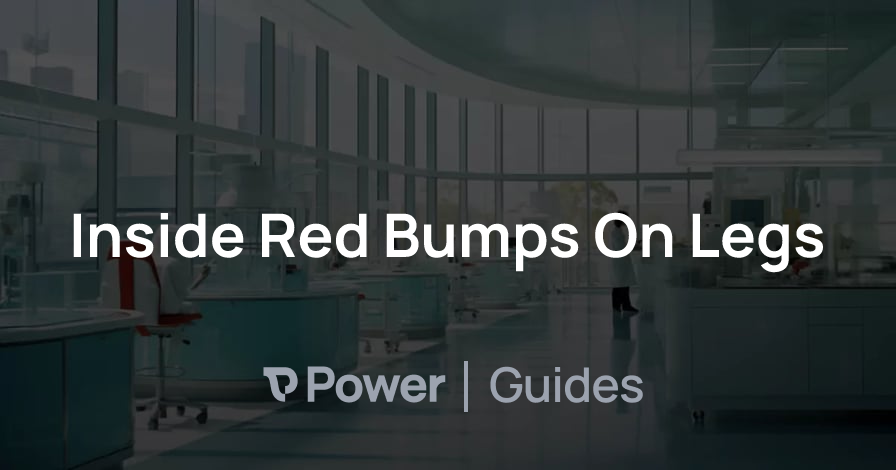 Header Image for Inside Red Bumps On Legs