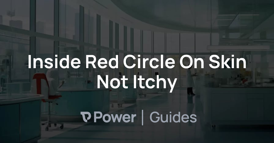 Header Image for Inside Red Circle On Skin Not Itchy