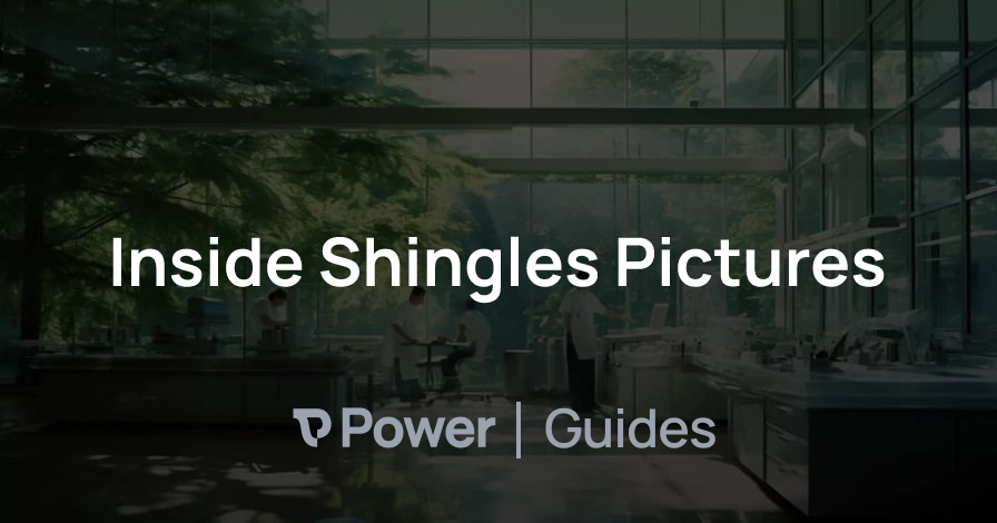 Header Image for Inside Shingles Pictures