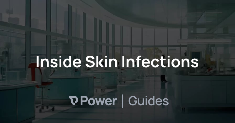 Header Image for Inside Skin Infections