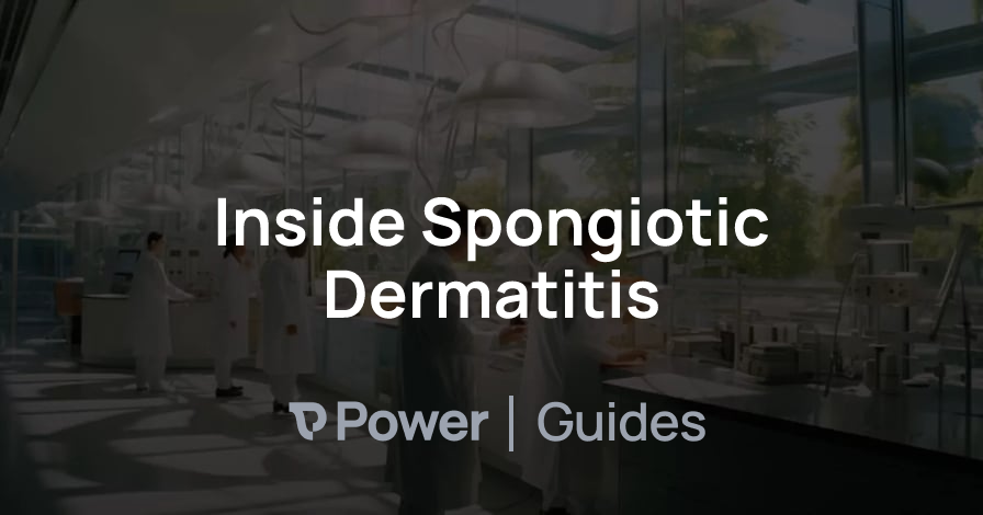 Header Image for Inside Spongiotic Dermatitis