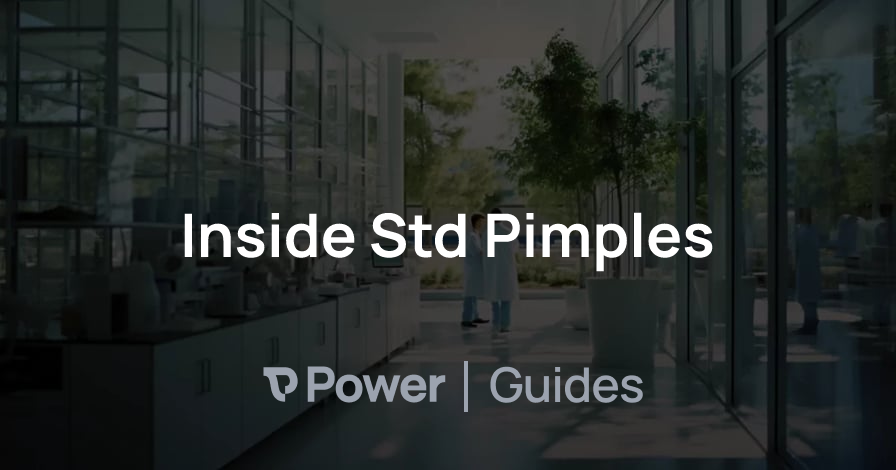 Header Image for Inside Std Pimples