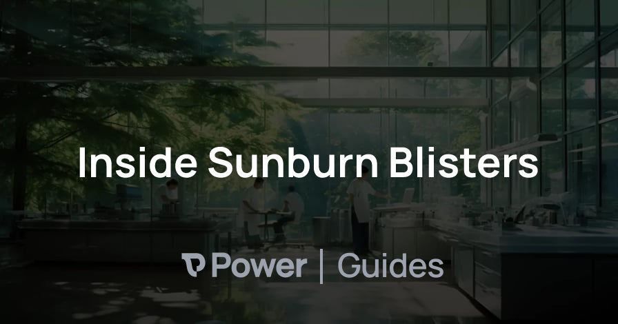 Header Image for Inside Sunburn Blisters