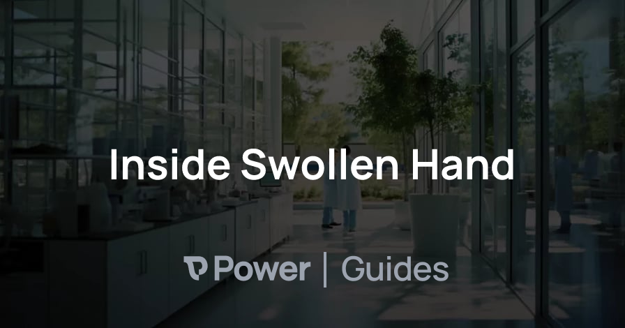 Header Image for Inside Swollen Hand