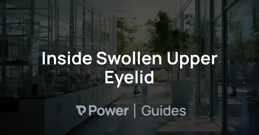 Header Image for Inside Swollen Upper Eyelid