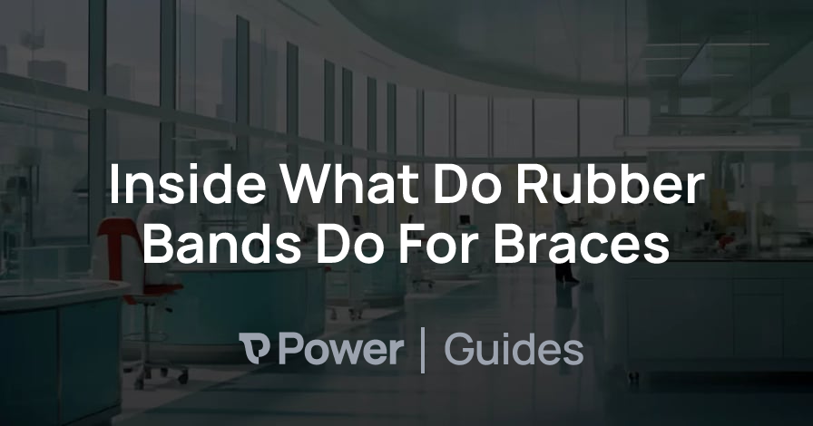 Header Image for Inside What Do Rubber Bands Do For Braces