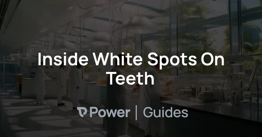 Header Image for Inside White Spots On Teeth