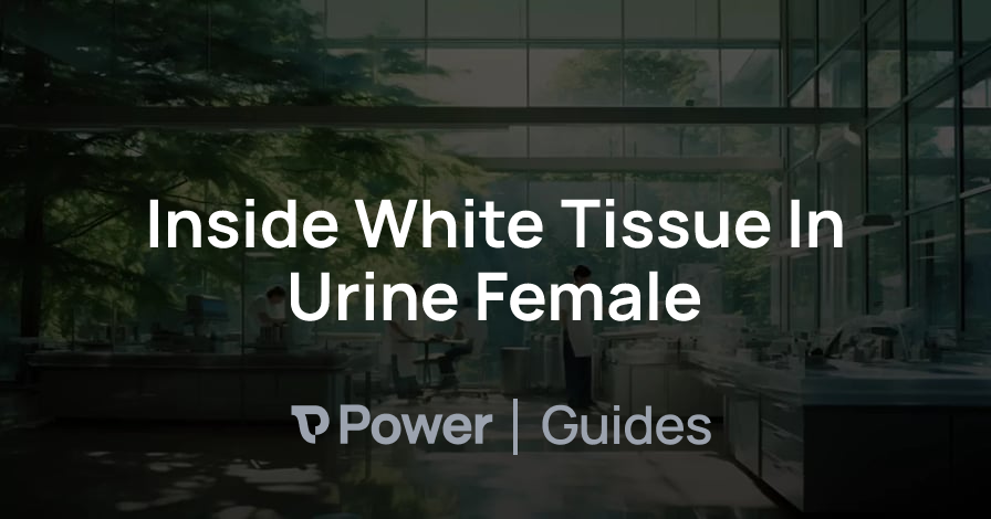 Header Image for Inside White Tissue In Urine Female