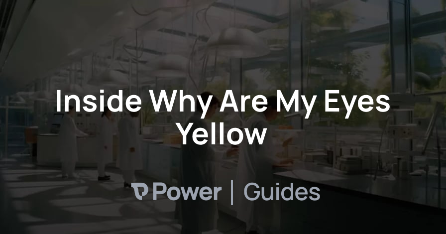 Header Image for Inside Why Are My Eyes Yellow