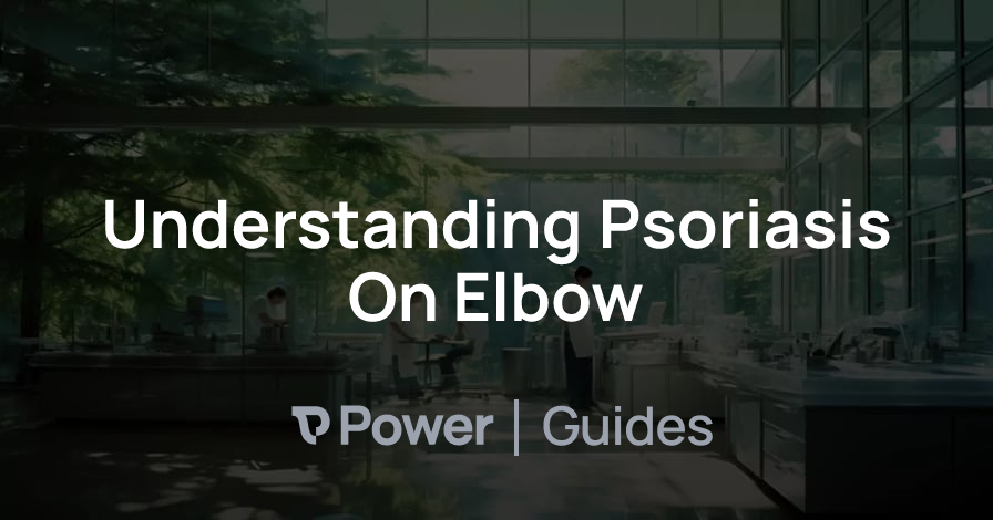 Header Image for Understanding Psoriasis On Elbow