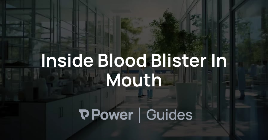 Header Image for Inside Blood Blister In Mouth
