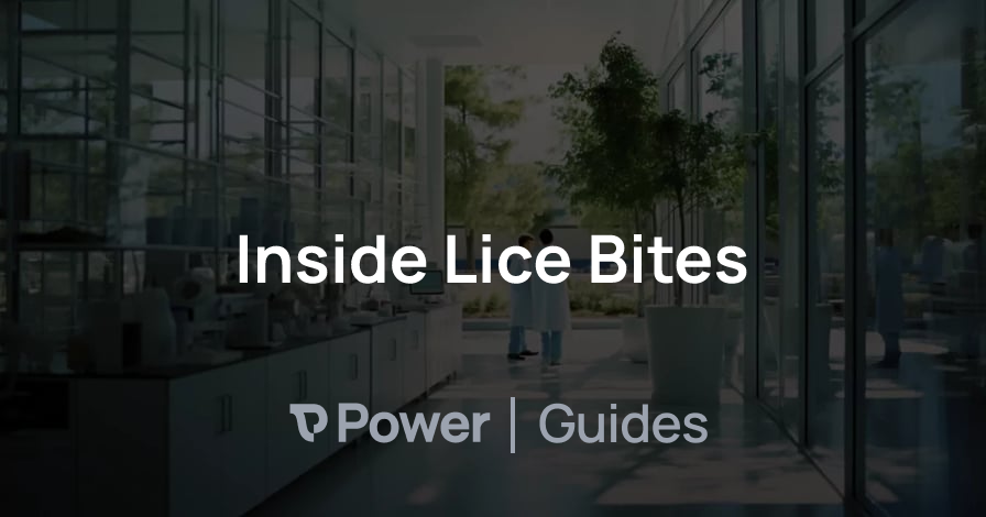 Header Image for Inside Lice Bites